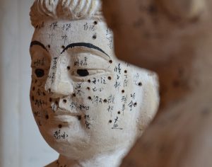 Chinesische Medizin: Akupunktur